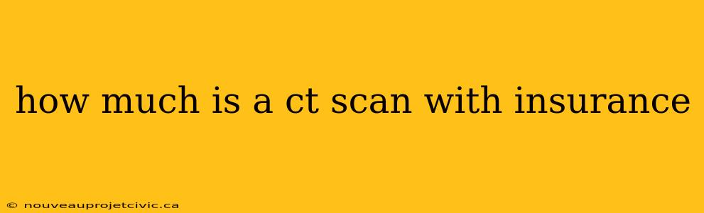 how much is a ct scan with insurance