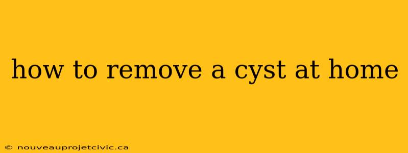 how to remove a cyst at home