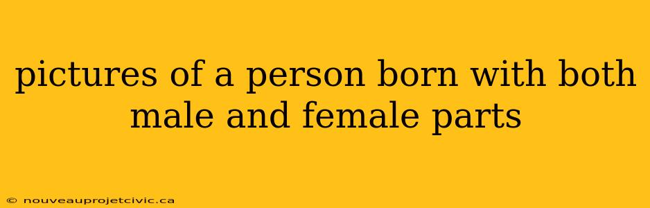 pictures of a person born with both male and female parts